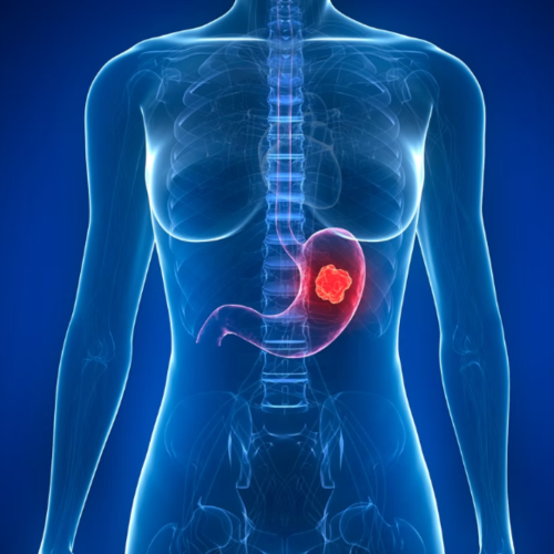 Design sem nome (46)